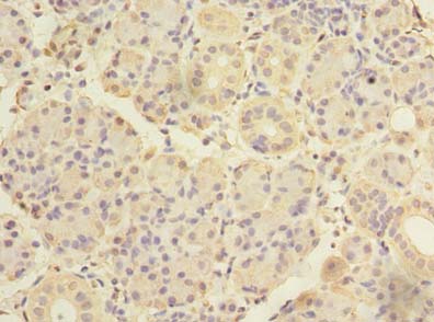 Immunohistochemistry of paraffin-embedded human pancreatic tissue using ASB8 Polyclonal Antibody at dilution of 1:100