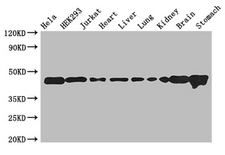 ASCC1 Polyclonal Antibody
