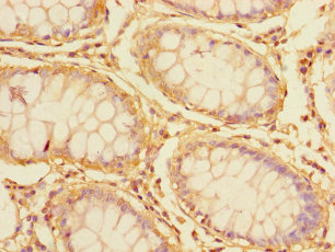 ATP1B3 Polyclonal Antibody