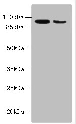 ATP2A2 Polyclonal Antibody (100 µl)