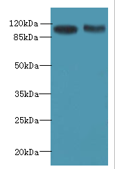 ATP2A2 Polyclonal Antibody