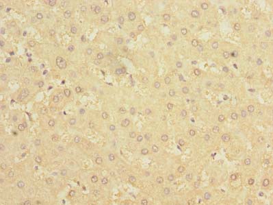 BDH2 Polyclonal Antibody