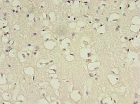 BDNF Polyclonal Antibody