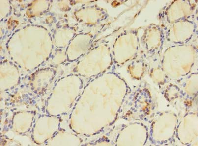 BEX2 Polyclonal Antibody