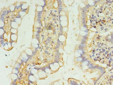 BRINP2 Polyclonal Antibody (50 µl)