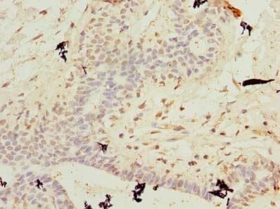 C10orf62 Polyclonal Antibody