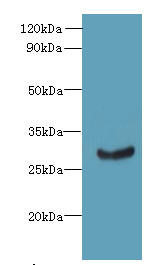 C11orf68 Polyclonal Antibody