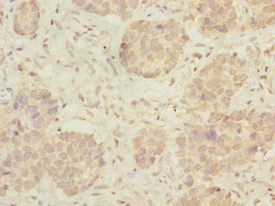 C15orf40 Polyclonal Antibody