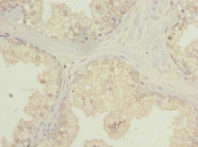 C20orf195 Polyclonal Antibody