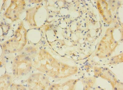 C2orf69 Polyclonal Antibody