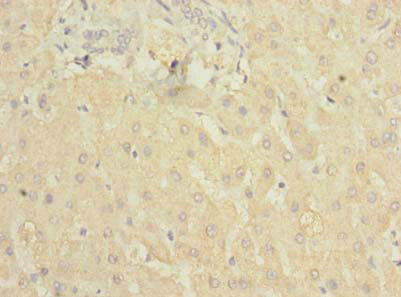 C5 Polyclonal Antibody