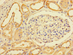 C6orf203 Polyclonal Antibody