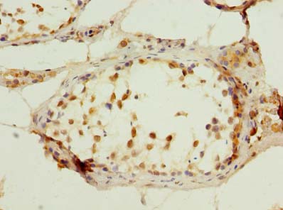 C7orf61 Polyclonal Antibody