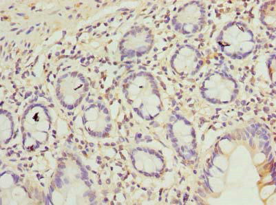 C9orf16 Polyclonal Antibody