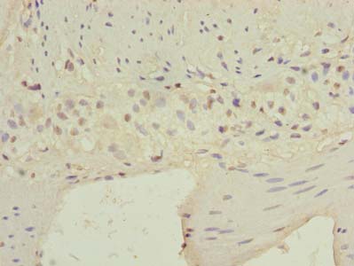 CARD19 Polyclonal Antibody