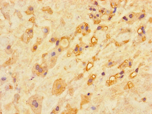 CA11 Polyclonal Antibody