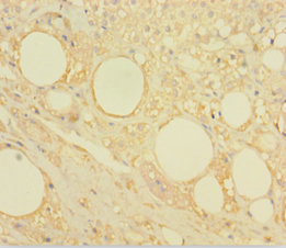 CASK Polyclonal Antibody