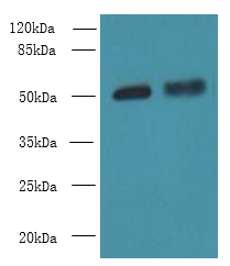 CBX2 Polyclonal Antibody