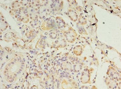 CCDC109B Polyclonal Antibody