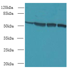 CCDC112 Polyclonal Antibody