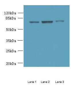 CCDC116 Polyclonal Antibody