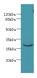 CCDC127 Polyclonal Antibody (100 µl)