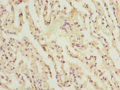 CCDC181 Polyclonal Antibody