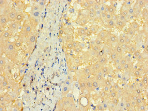 CCDC68 Polyclonal Antibody