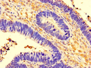 CCDC91 Polyclonal Antibody