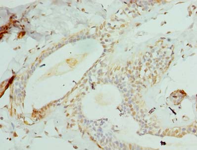 CCDC97 Polyclonal Antibody