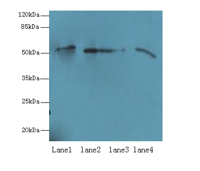 CEACAM1 Polyclonal Antibody
