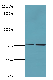 CFHR2 Polyclonal Antibody