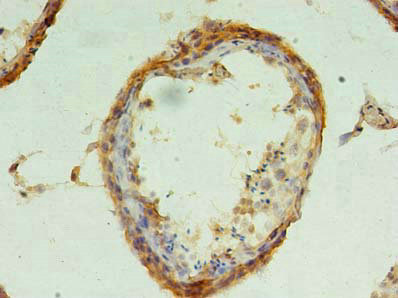 CHMP6 Polyclonal Antibody