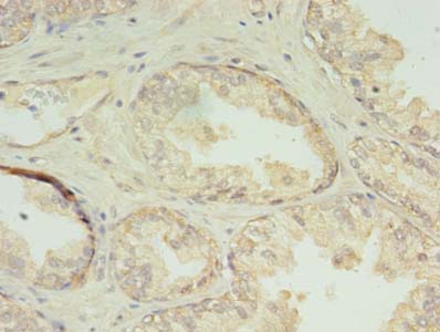 CHMP7 Polyclonal Antibody