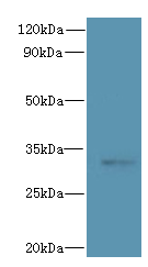 CLEC1A Polyclonal Antibody (100 µl)