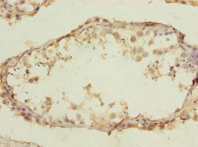 CLEC4C Polyclonal Antibody