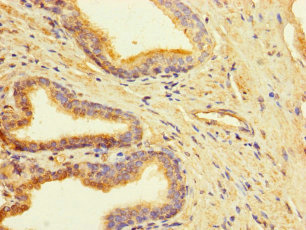 CLUAP1 Polyclonal Antibody