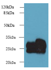 CMBL Polyclonal Antibody