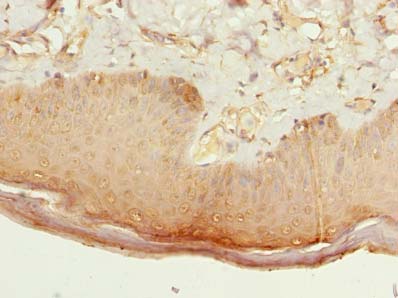 CMTR2 Polyclonal Antibody