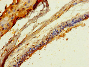 COL20A1 Polyclonal Antibody