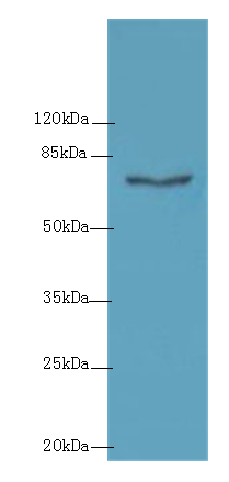 COLGALT2 Polyclonal Antibody