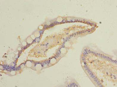 COMMD9 Polyclonal Antibody (50 µl)