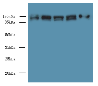 COPB1 Polyclonal Antibody