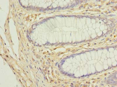 COX11 Polyclonal Antibody