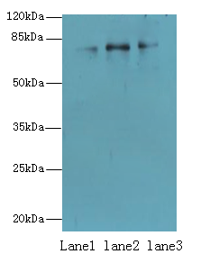 CPEB4 Polyclonal Antibody