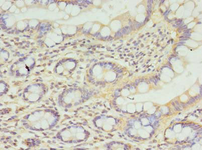 CPED1 Polyclonal Antibody