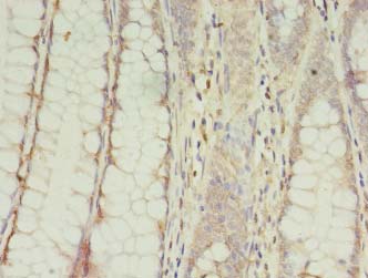 CPNE9 Polyclonal Antibody