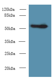 Csad Polyclonal Antibody