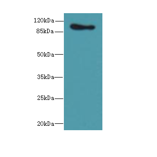 CTNNA1 Polyclonal Antibody