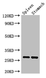 CTRB1 Polyclonal Antibody